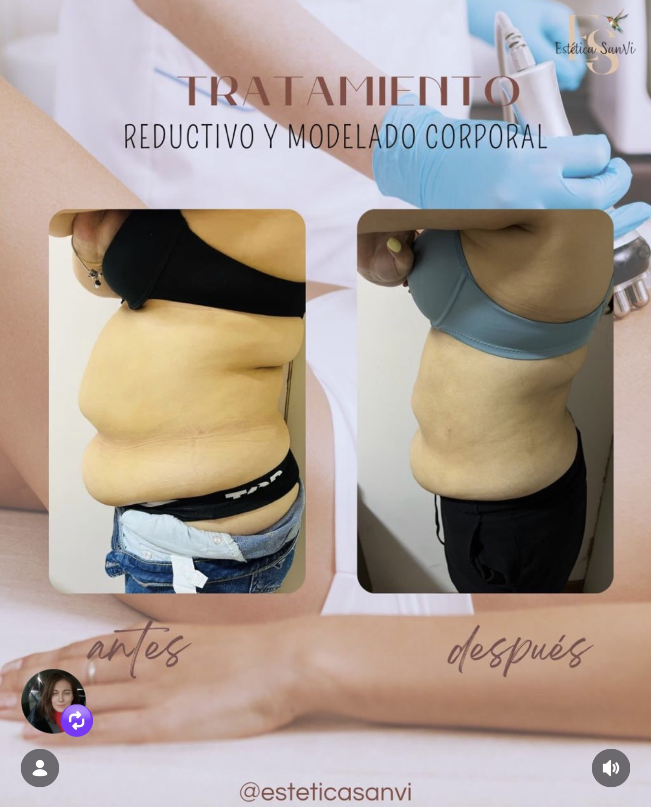 Antes de lifting de pestañas y tinte – Estética SanVi San Vicente de Tagua Tagua